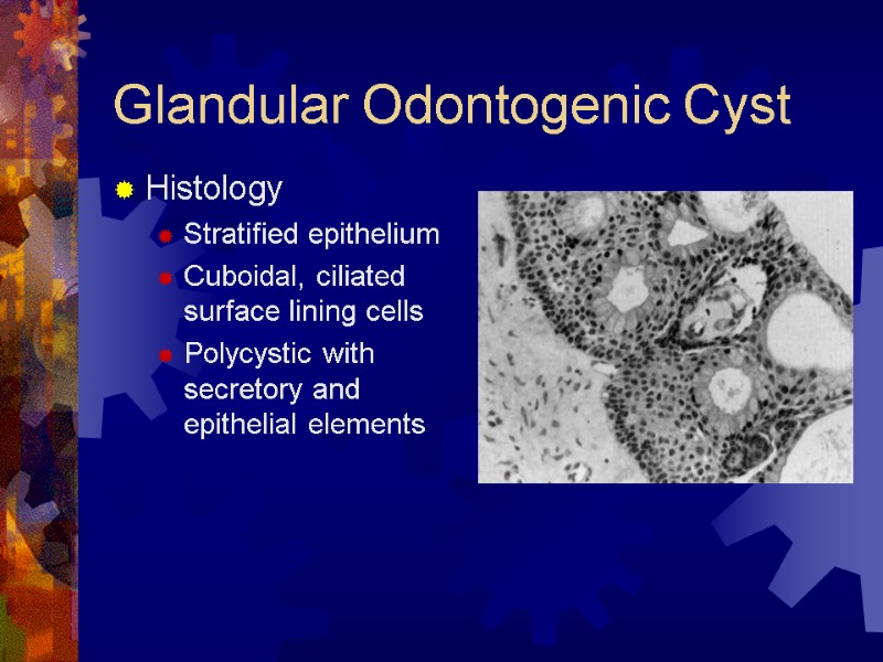 Glandular Odontogenic Cyst Histology Stratified epithelium Cuboidal, ciliated surface lining cells Polycystic with secretory